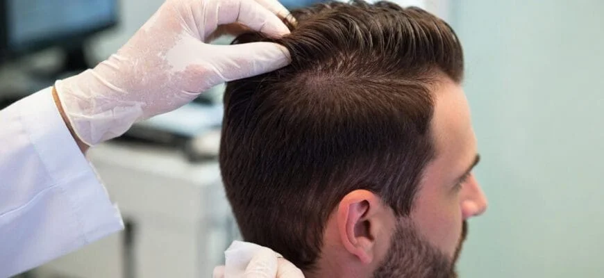 Hair specialist examining damaged hair follicles on the scalp