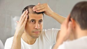 Man checking hairline after best hair transplant in Lahore